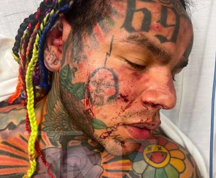 El rapero Tekashi 6ix9ine fue hospitalizado tras recibir una brutal golpiza