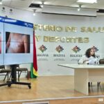 Emiten alerta epidemiológica en Bolivia por un caso de sarampión confirmado en Oruro