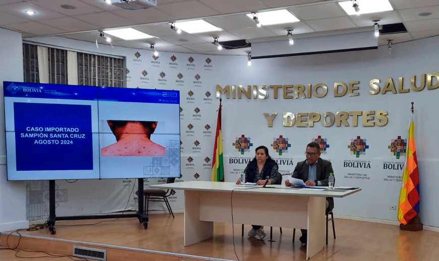 Ministerio de Salud confirma un caso de sarampión en Santa&hellip;