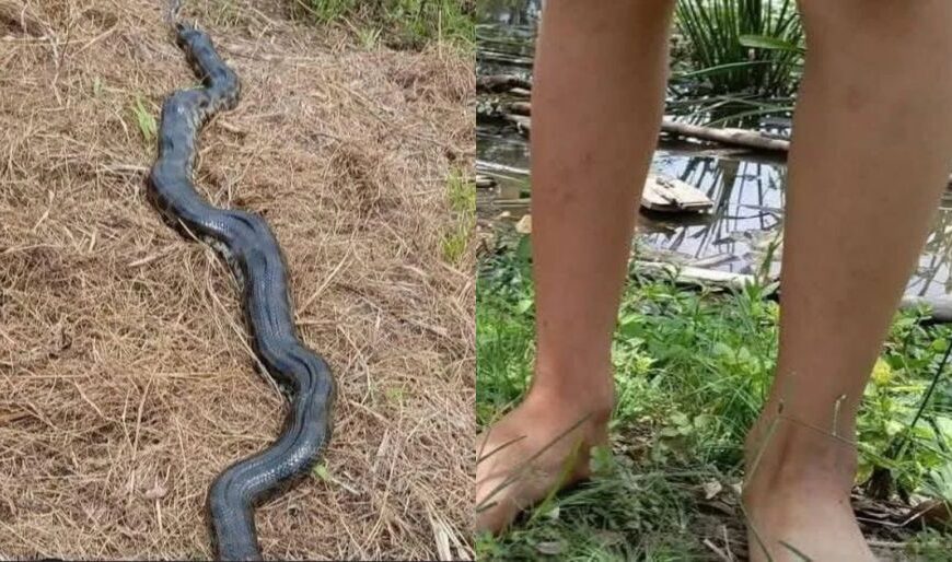 Niño de 10 años es atacado por una sicurí de…